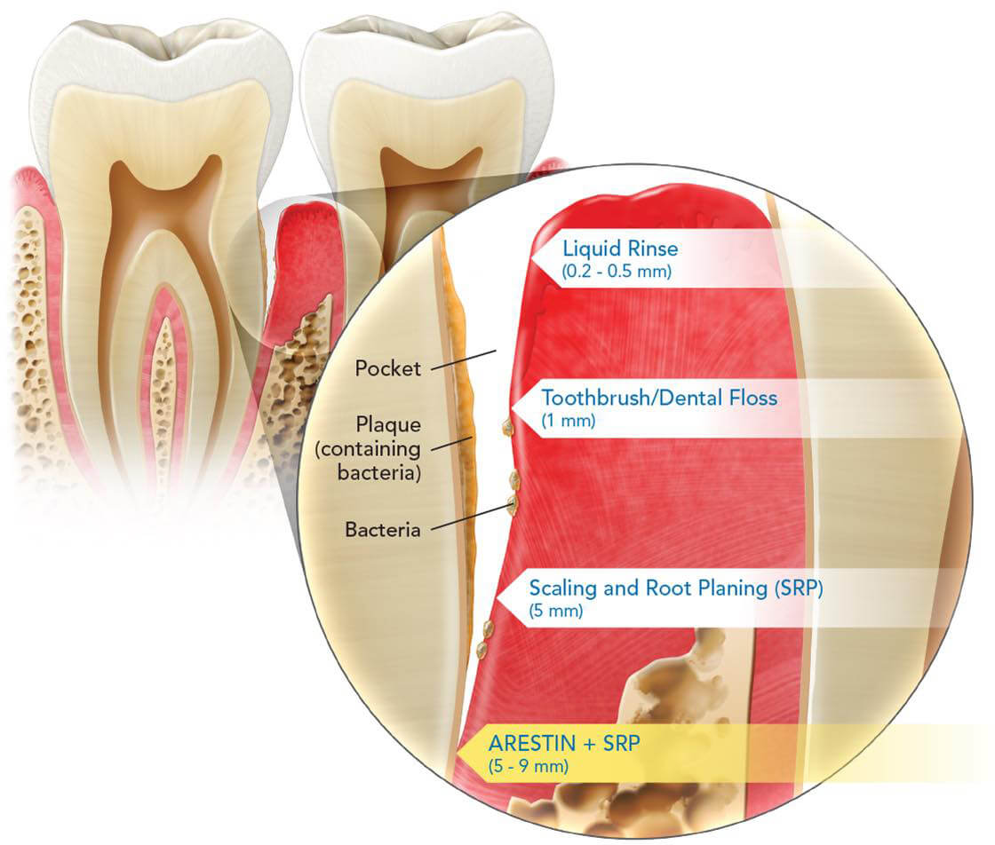 depth of penetration