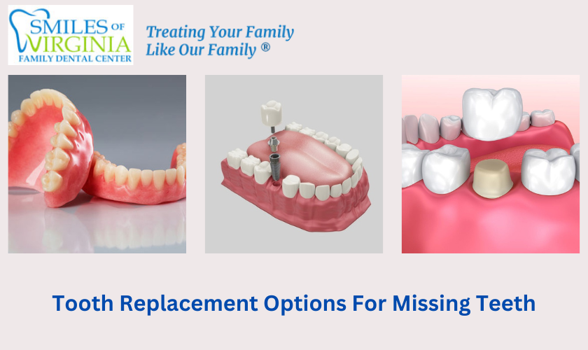 Tooth Replacement Options For Missing Teeth