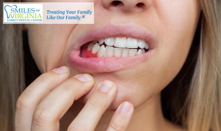 Symptoms of Periodontal Disease