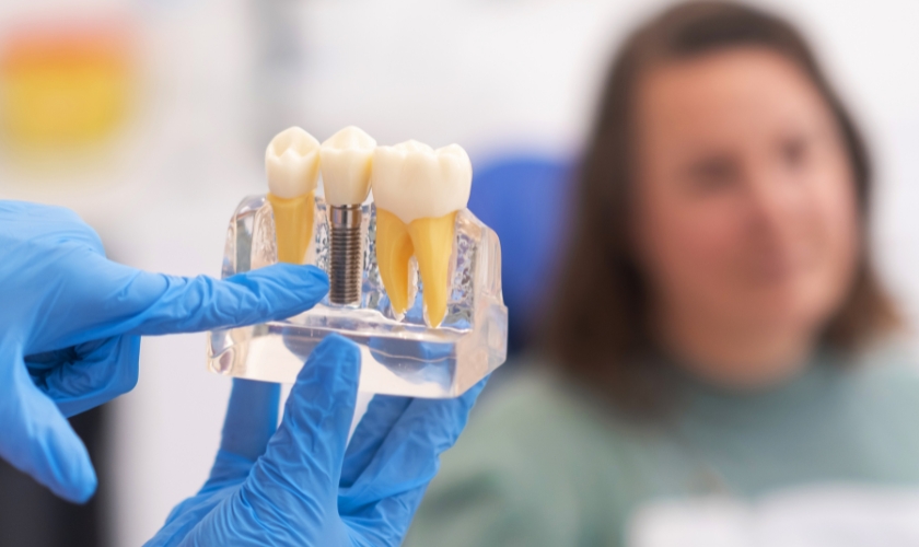 Dental Implant in Winchester Success Rates: What to Expect From the Procedure