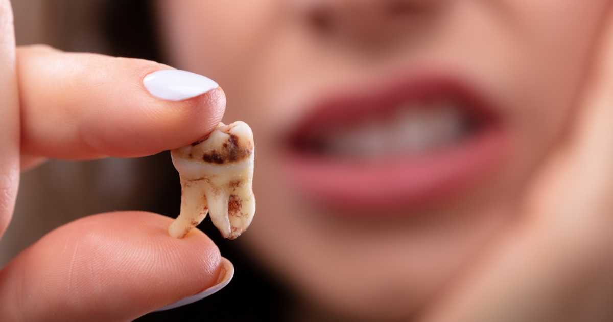understanding the consequences of untreated tooth decay