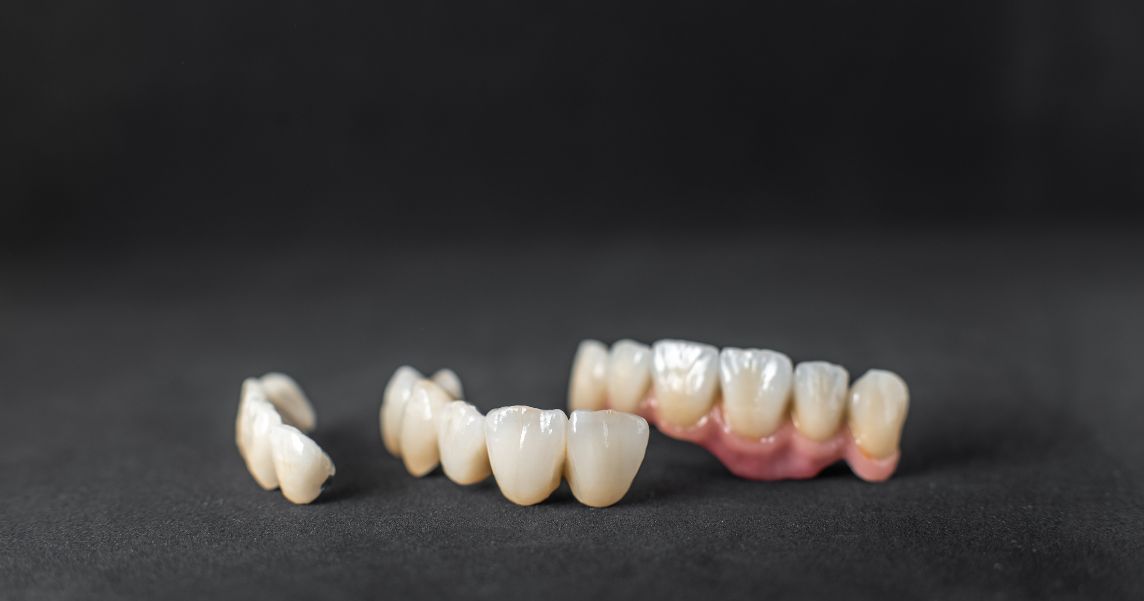 broken dental crown with options to repair or replace