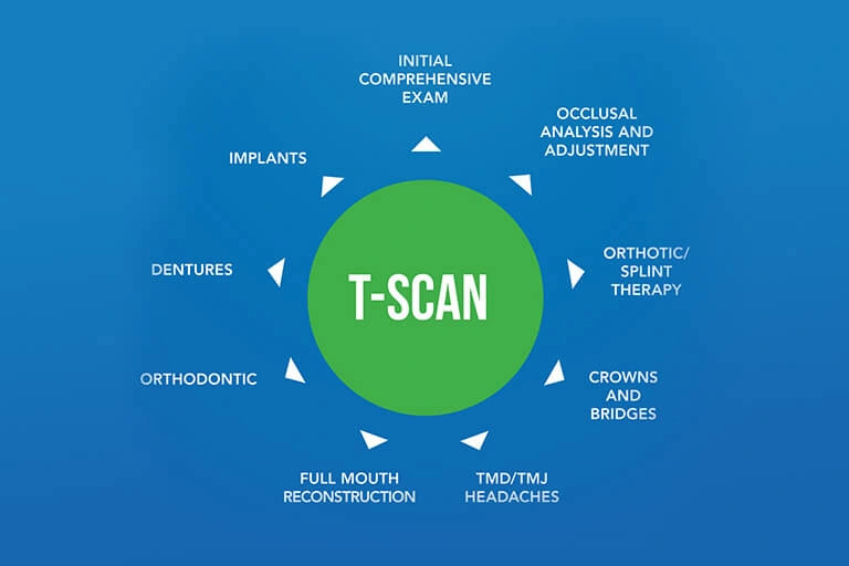 2 Acid Etched Bridge